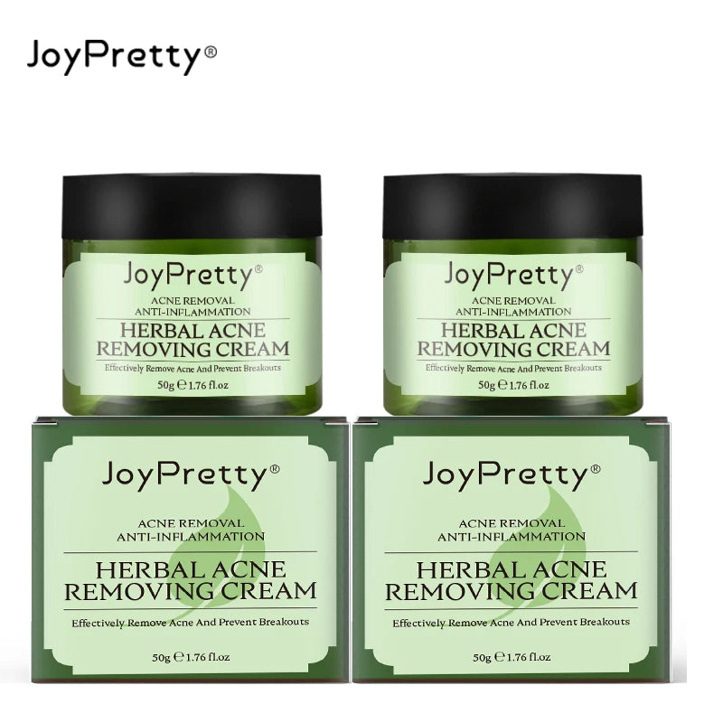 Creme para limpeza Pele e remoção de Acnes
