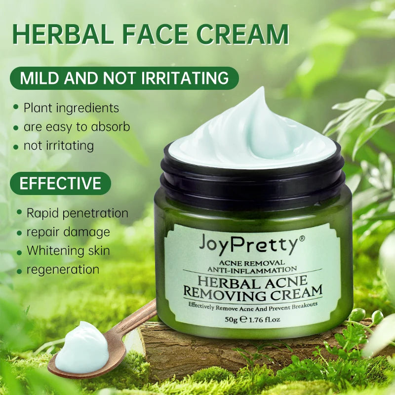Creme para limpeza Pele e remoção de Acnes