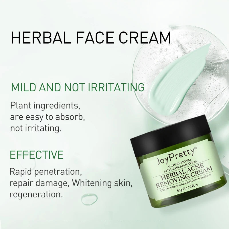 Creme para limpeza Pele e remoção de Acnes