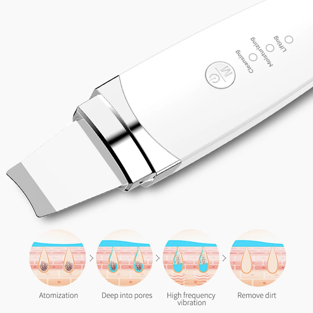 Espátula Ultrassônica Facial – Limpeza e Lifting