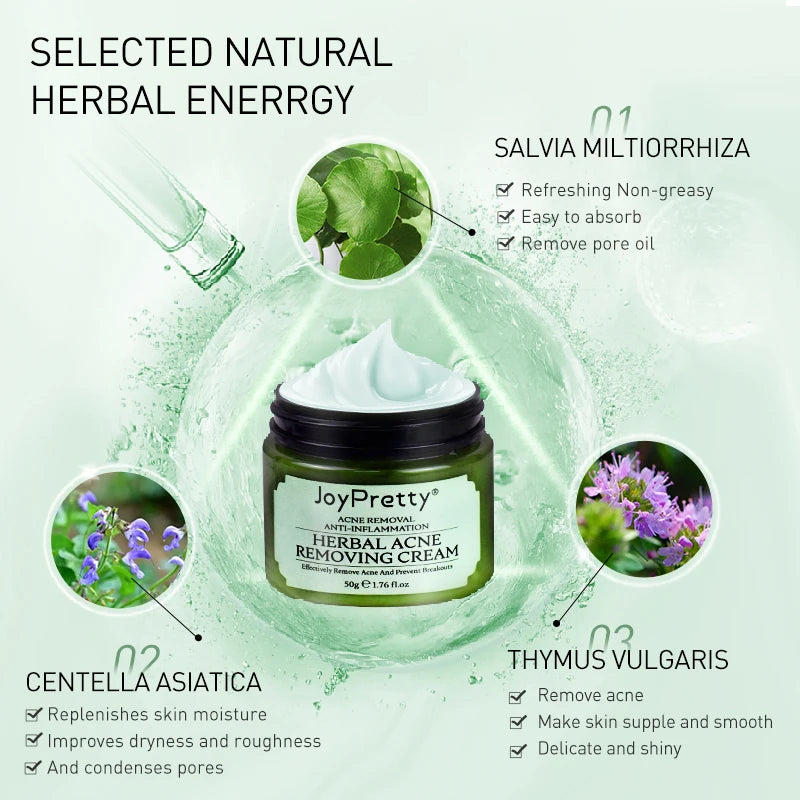 Creme para limpeza Pele e remoção de Acnes