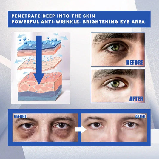 Creme para Olhos com Retinol Masculino – Antiolheiras, Antiinchaço e Hidratante