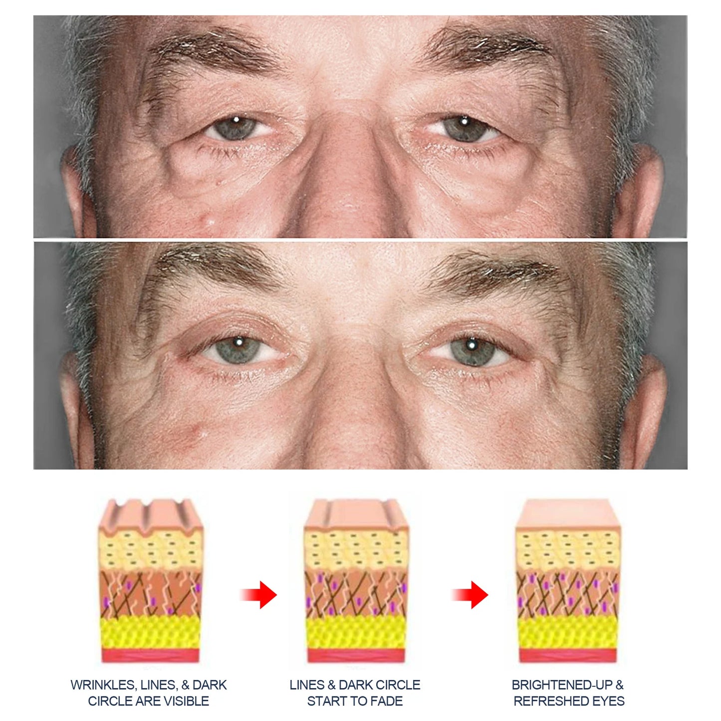 Creme para Olhos com Retinol Masculino – Antiolheiras, Antiinchaço e Hidratante