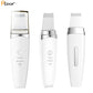 Espátula Ultrassônica Facial – Limpeza e Lifting